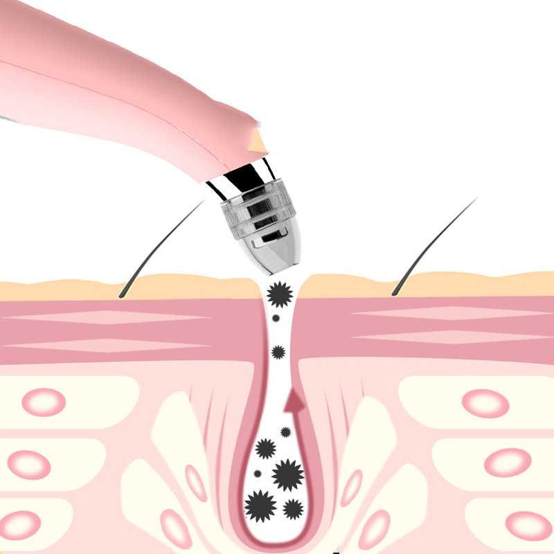 Blackhead Meter,Pore Removal Machine,Cleaning Instrument